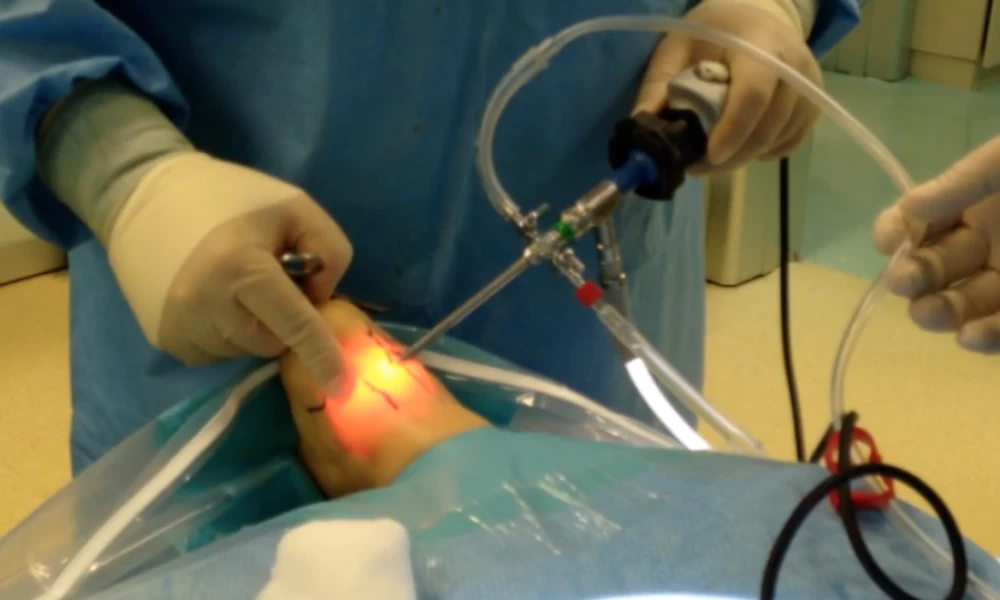 Θα τρελαθούμε: Γιατροί ακρωτηρίασαν...λάθος πόδι ασθενή!